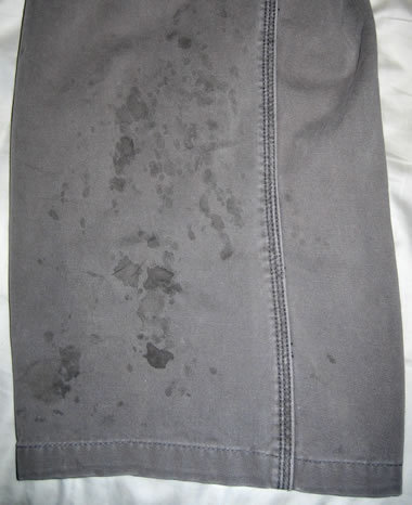 Pant leg stained with weeping blisters from poison oak